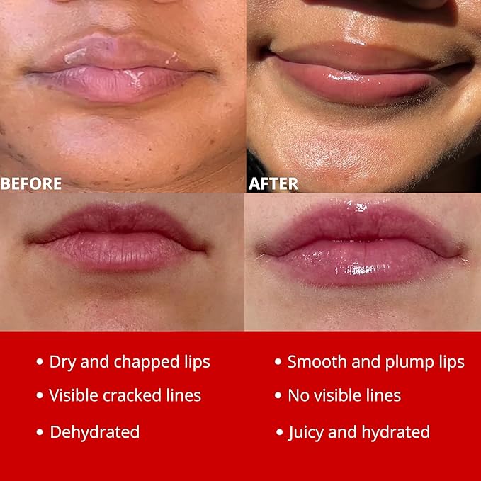 Original My Bee Balm Lip Balm - Candy Cane Hydrating Balm Honey Pot for Dry, Chapped & Cracked Lips with Propolis, Honey & Vitamin E - Soften, Smooth & Reduce Lip Lines