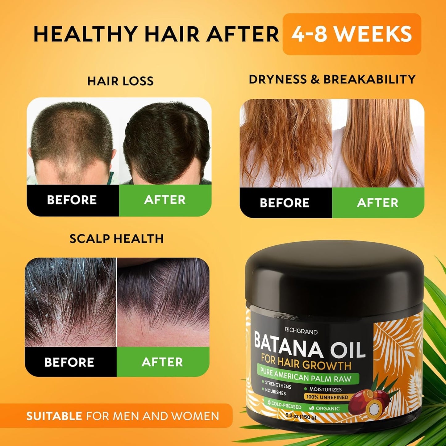Batana Oil for Hair Growth - 100% Raw & Organic Dr Sebi Batana Oil - Cold-Pressed & Pure Unrefined Batana Hair Mask for Women & Men - Enhances Hair Thickness, Prevents Loss