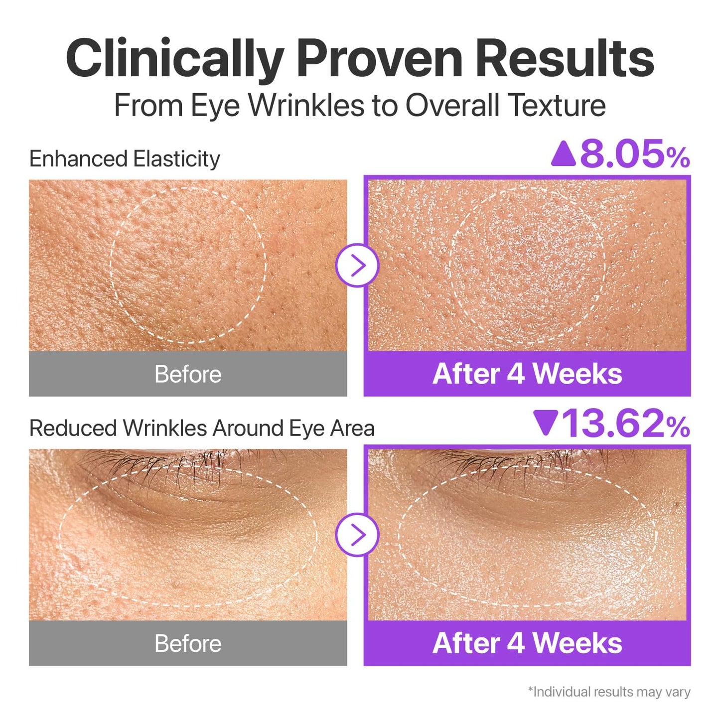 numbuzin No.9 Essence | NAD+ BIO Lifting-sil Essence | Firming, Reduce Wrinkles, Fine Lines | Peptides, NAD+ | Serum for Sagging, Aging, Dull Skin | 1.69 fl. oz.