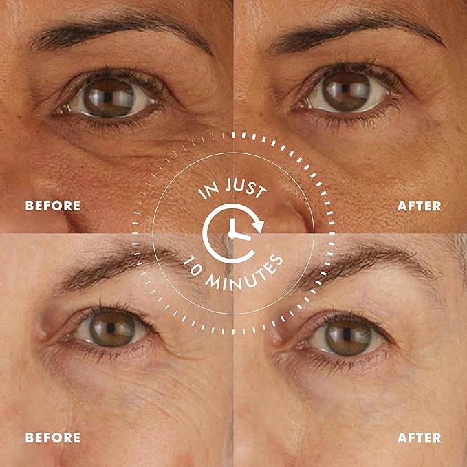 skyn ICELAND Hydro Cool Firming Under Eye Patches with Peptides and Coenzyme Q10 Instant Cooling Relief for Tired Puffy Eyes, 4 Pairs