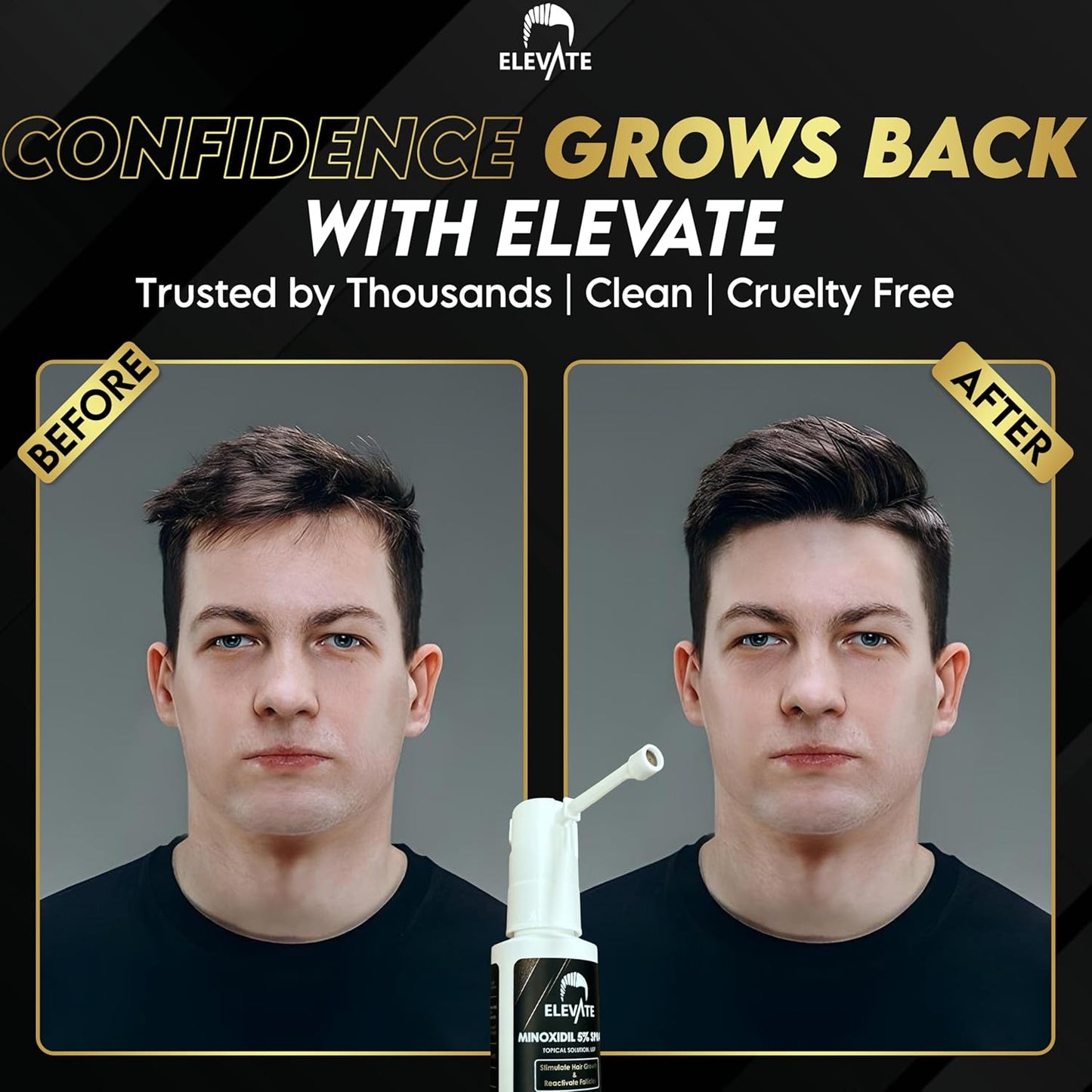 Elevate Hair Regrowth Treatment 5% Minoxidil Spray for Men - Clinically Proven Formula Fast Absorbing for Hair Loss and Growth Unscented Topical Hair Spray for Thinning & Balding Hair - Made in USA