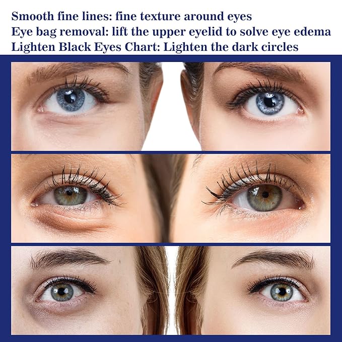 Under Eye Cream for Puffiness & Bags,Active Eye Serum for Dark Circles and puffiness,Under Eye Caffeine Eye Serum Reduce Wrinkles (30ml)