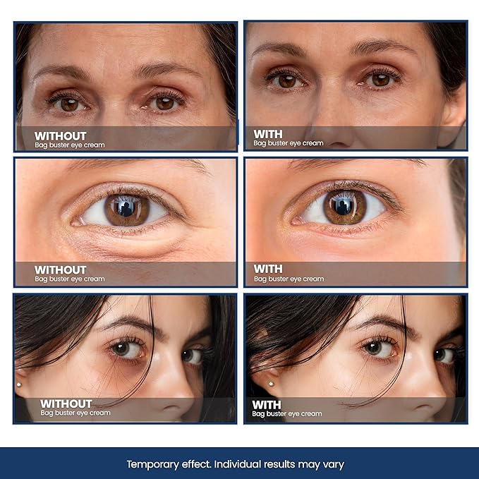 Bag Buster Eye Cream - Rapid Firming and Anti-Wrinkle Neck Serum | Face Serum for Women