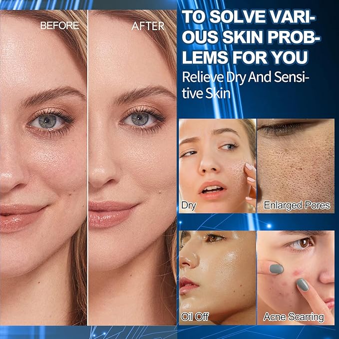 O'KADY Skin Care Set Rejuvenating Beauty Luxury 8-Piece Set Skin Care SetSkincare Gifts For Teenage Girls,Facial kit,Pamper Sets For Women Gifts,Skin Care Sets for Valentine's Day