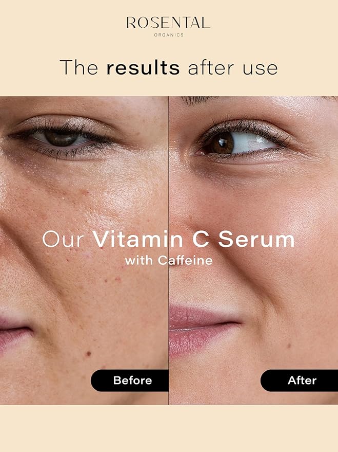 Organics Hydrating Facial Serum - 100% Vegan & Natural Cosmetics (30 ml, Vitamin C Serum)