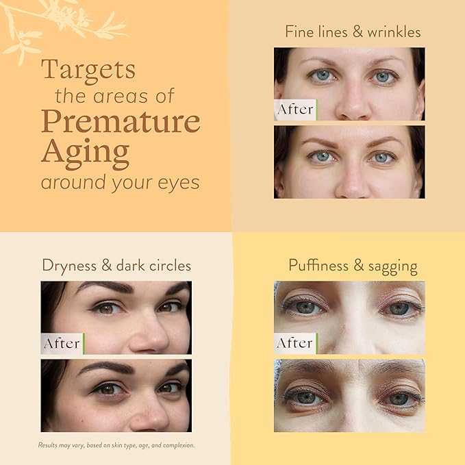 LILY SADO CITRUS KISS™ Eye Repair Cream - Antioxidant-Rich Natural Formula w/Peptides, Sodium Hyaluronate, and VITS C, B5 & E - Prevents Puffiness, Under-eye Wrinkles, Discoloration & Eye Bags - 1oz