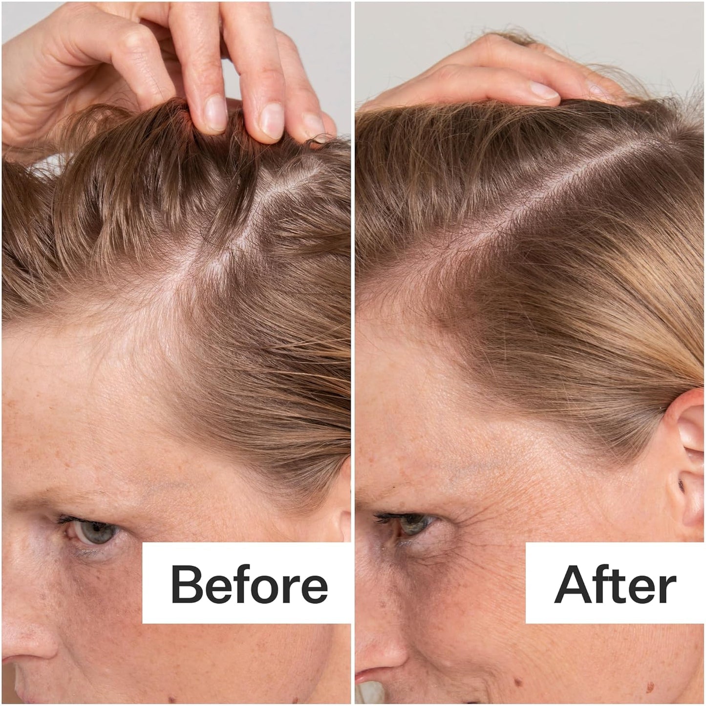 Act+Acre Cold Processed Salicylic Acid Exfoliator | For Loose Flakes, Excess Oil, Scalp Build-Up | Salicylic Acid, Papaya, Peppermint | Balance, Soothe | Vegan, Color Safe, Fragrance-Free | 2 Fl Oz