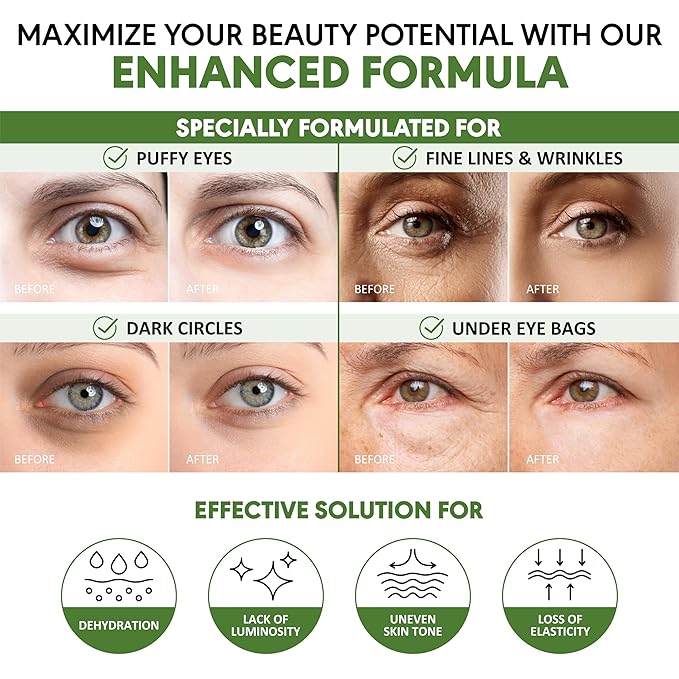 Eye Masks for Dark Circles and Puffiness – Hydrating Eye Patches with Collagen Hyaluronic Acid Green Tea & Aloe - Under Eye Treatment for Women and Men 30 Pairs