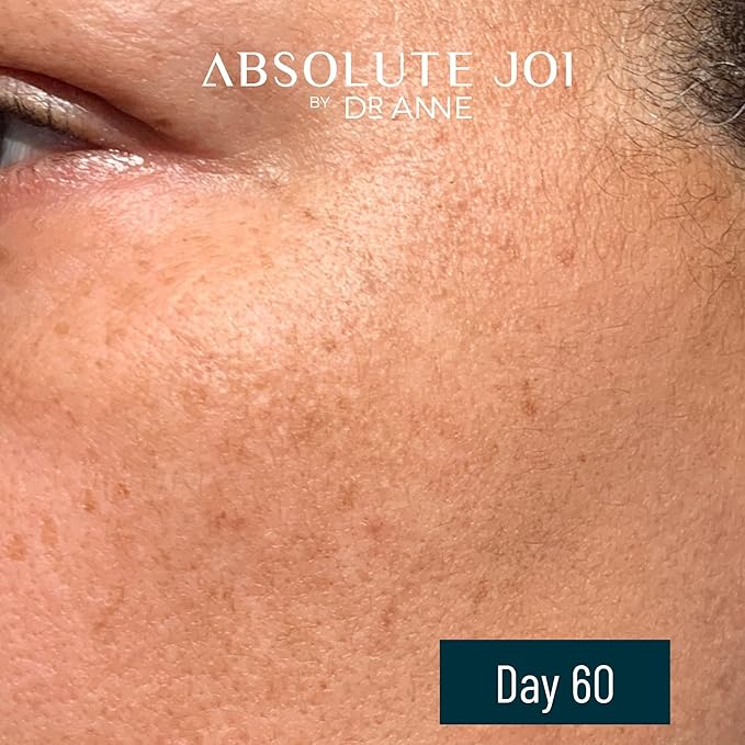 Retinol Oil Serum with Vitamin C, Skin Refining Night Oil for Fine Lines and Hyperpigmentation with Sensitive Skin Friendly Granactive Retinoid - Unscented - 1 Fl Oz Full Size