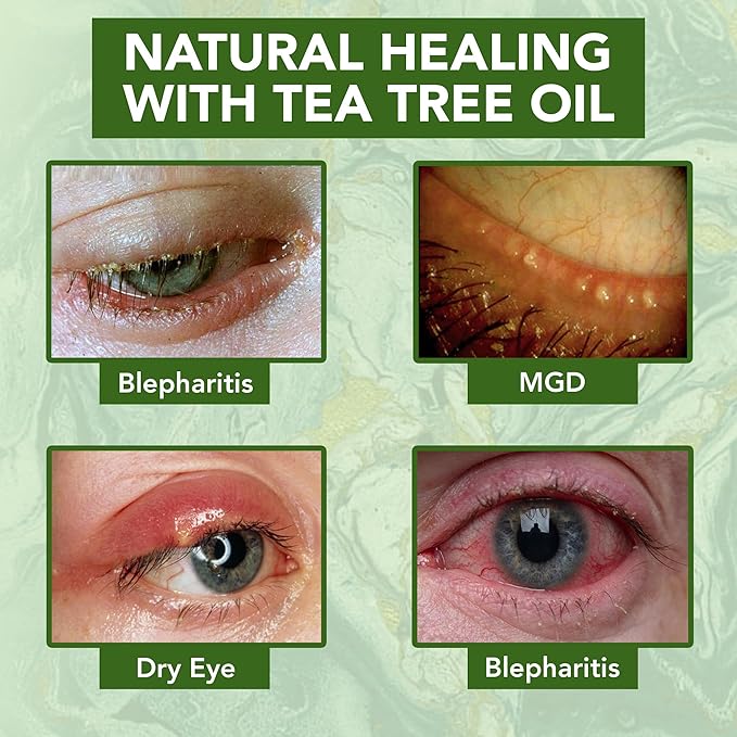 NOVEHA Tea Tree Oil Anti Wrinkle Eye Cream - Eyelid Cream for Dry & Itchy Skin, Scar | Moisturizer Face Cream Treatment - 1.69 Fl. Oz.