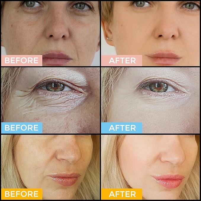 Facial Skin Care Set– Retinol Serum, Vitamin C & Hyaluronic Acid for Face – Anti Aging Face Serum Set for Women – Firm, Wrinkle Smoothing, Dark Spot Corrector, Brighten Dullness