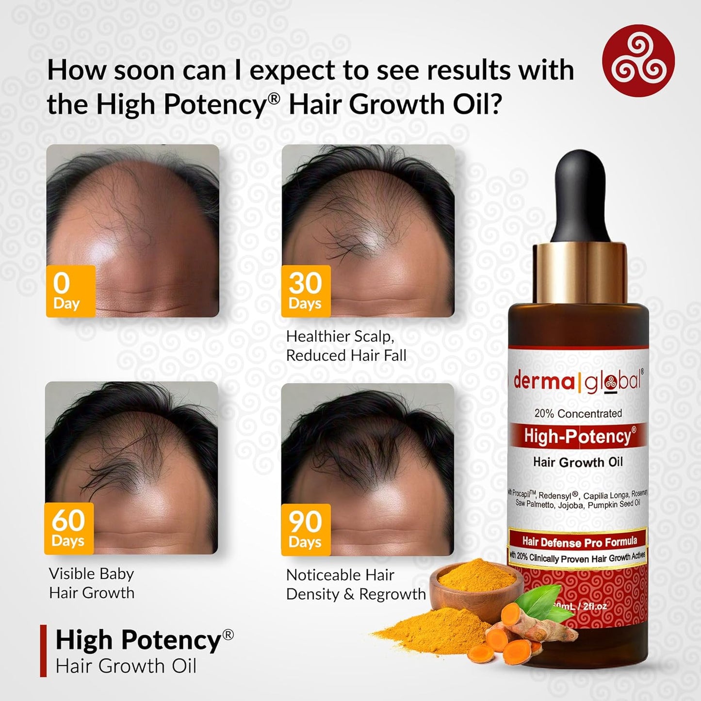 High Potency® Hair Growth Oil – Hair Defence Pro Formula | 20% Clinically Proven Actives including Procapil, Redensyl, Capilia Longa, Rosemary, Saw Palmetto, Jojoba, Pumpkin Seed Oil