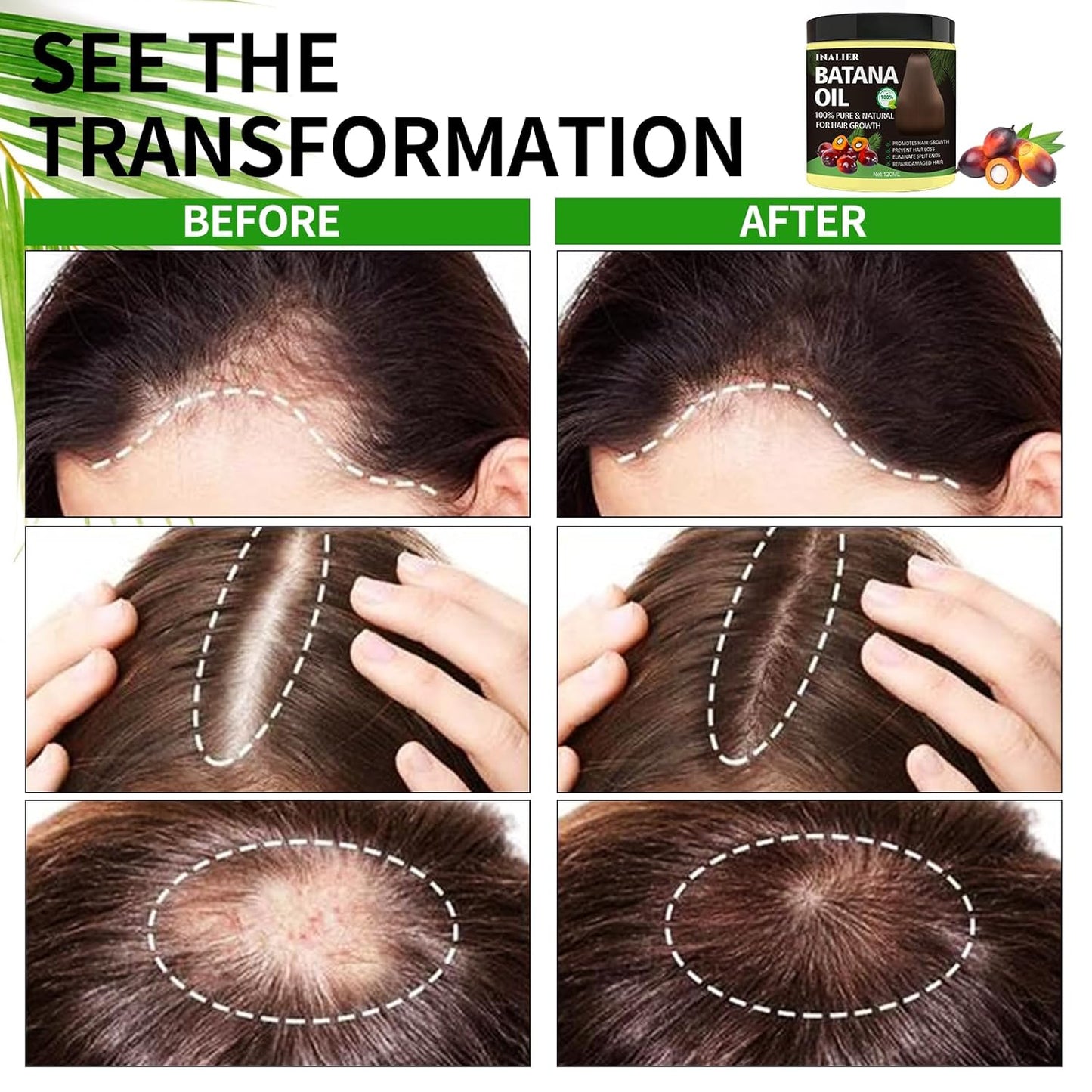 Batana Oil for Hair Growth – 100% Pure Raw Organic Hair Oil from Nature –Deep Repair Hair Treatment for Men and Women to Prevent Hair Loss & Enhance Thickness (4.2oz)