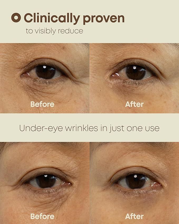 Ever-Youth Dual Effect Eye Cream Korean Skincare Instant Lifting Technology for Firm Eyes with Niacinamide Adenosine Hyaluronic Acid Ceramides for Fine Lines Bags Puffiness 0.5 fl oz