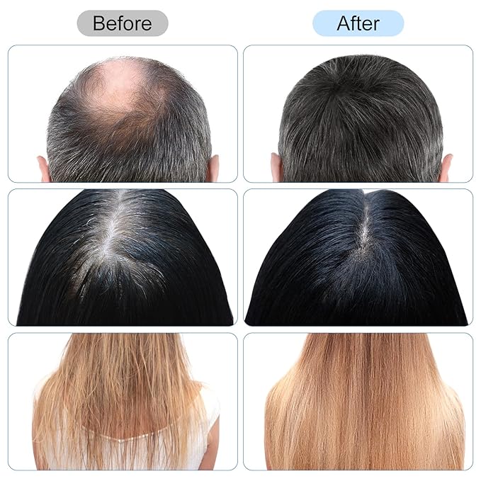 3-in-1 Hair Oil Applicator for Scalp with No-Drip Dispenser, Portable Hair Brush, Wireless Electric Scalp Massager for Travel and Home Use