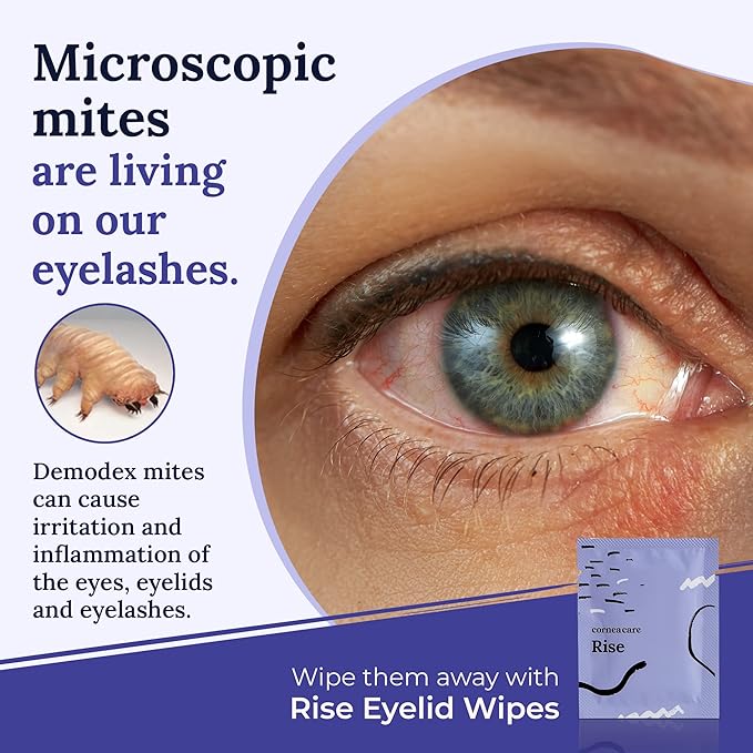 The Eyelid Hygiene Foundation | Self Heating Warm Compress for Eyes | Eye Wipes for Dry Eyes | Eye Compress for Puffy Eyes | Eye Mask for Fast Relief of Dry Eyes | Eyelid Wash Pads | Travel Friendly