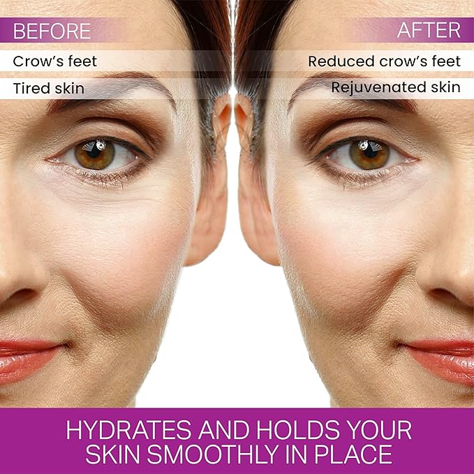 Crows Wrinkle Patches, Overnight Eye Patches for Wrinkles and Crow’s Feet Lines, Non-invasive Anti-Wrinkle Patches, Anti-aging Skincare, 60 Patches, 30-Day Use