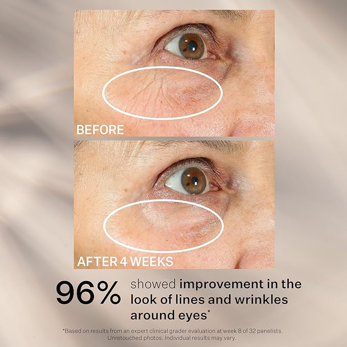 StriVectin Tighten and Lift Peptight 360 Degree Eye Serum with Tightening and Brightening Peptides for Wrinkles, Under Eye Bags and Puffiness, 1 fl. Oz