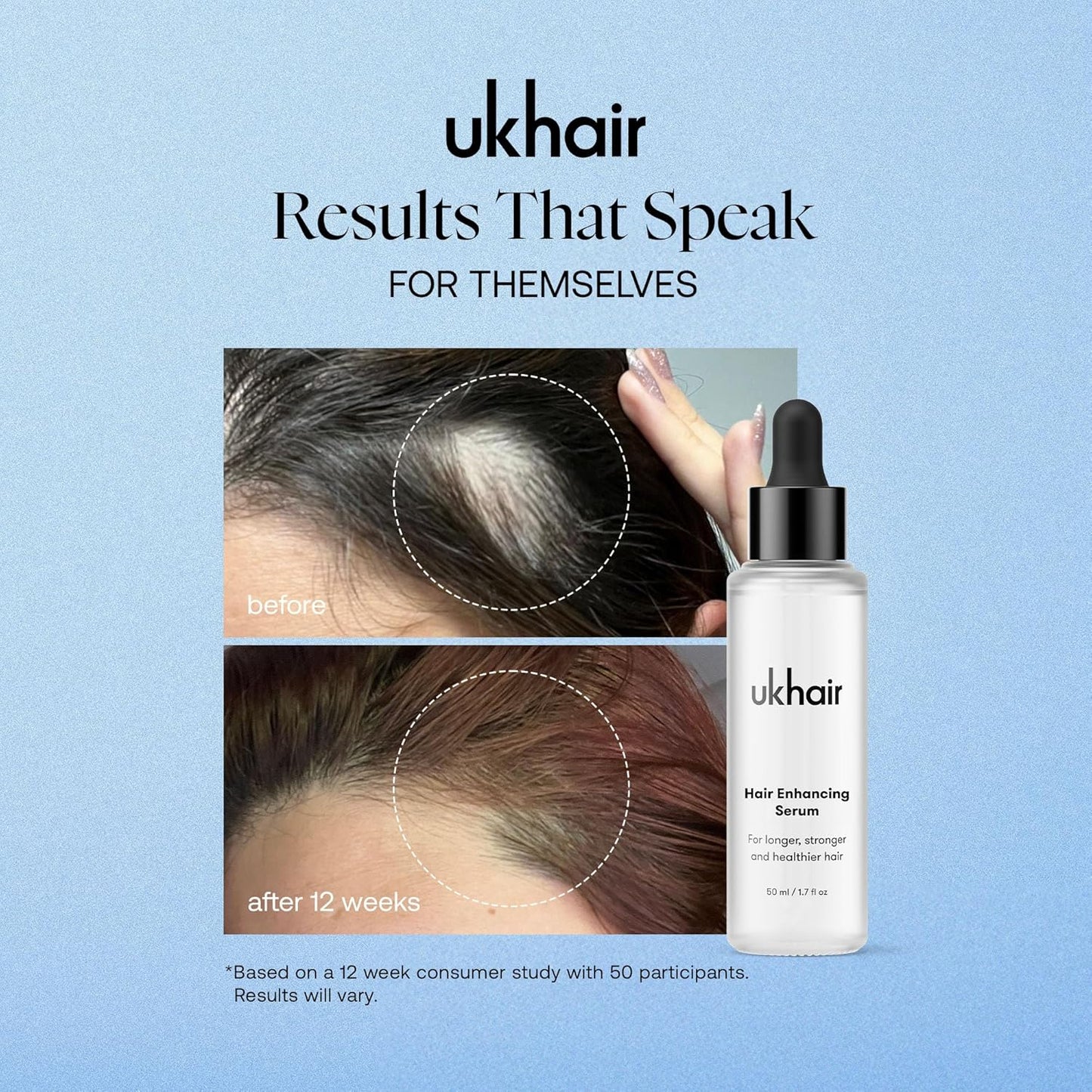 UKLASH Enhancing Hair Serum for Men and Women, Promotes Thickness in Thinning Hair & Hair Loss, Clinically Tested, Lightweight & Fast-Absorbing